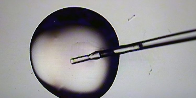 Republicans, pro-life advocates split on Trump’s proposal to federally subsidize IVF