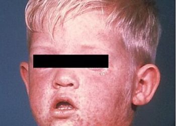 Red America Would Suffer Under RFK Jr.